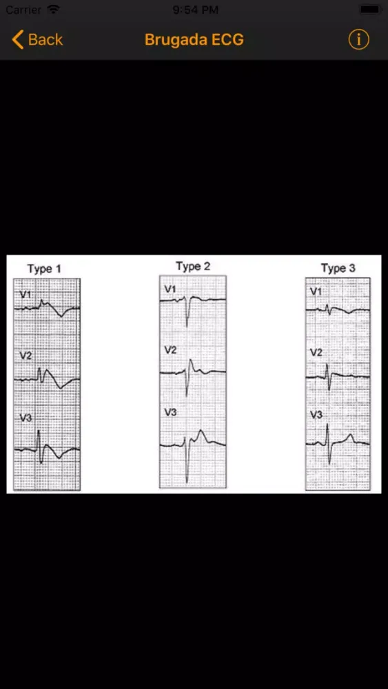 Tangkapan layar Electrophysiology Tools