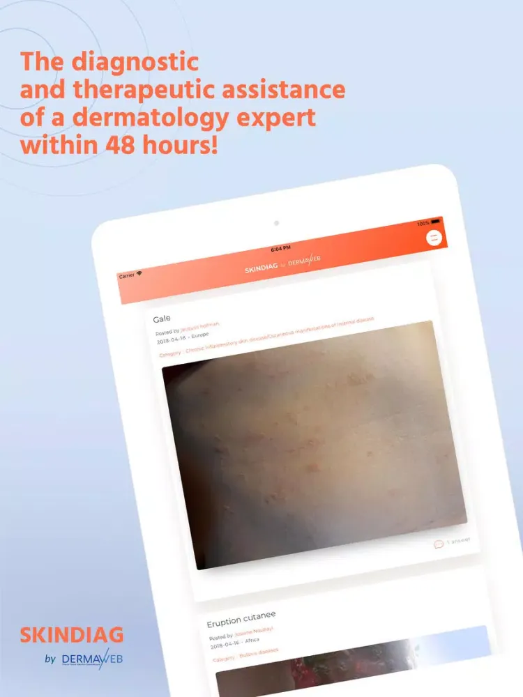 Zrzuty ekranu SKINDIAG by Dermaweb iPad 