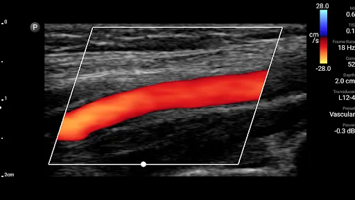 Philips Lumify Ultrasound App Ekran Görüntüleri