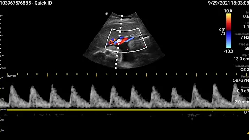Philips Lumify Ultrasound App Ekran Görüntüleri