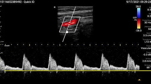Philips Lumify Ultrasound App Ekran Görüntüleri