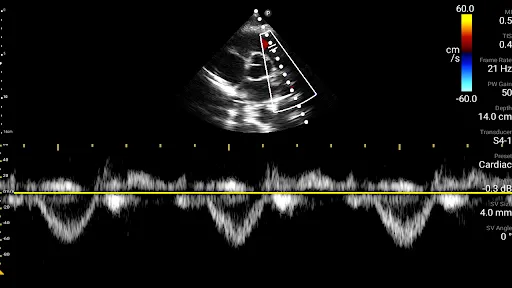 Philips Lumify Ultrasound App Ekran Görüntüleri