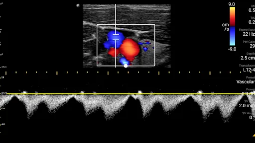 Philips Lumify Ultrasound App Ekran Görüntüleri