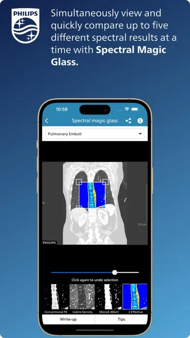 Philips CT Learning应用截图