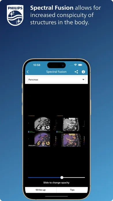 Philips CT Learning应用截图