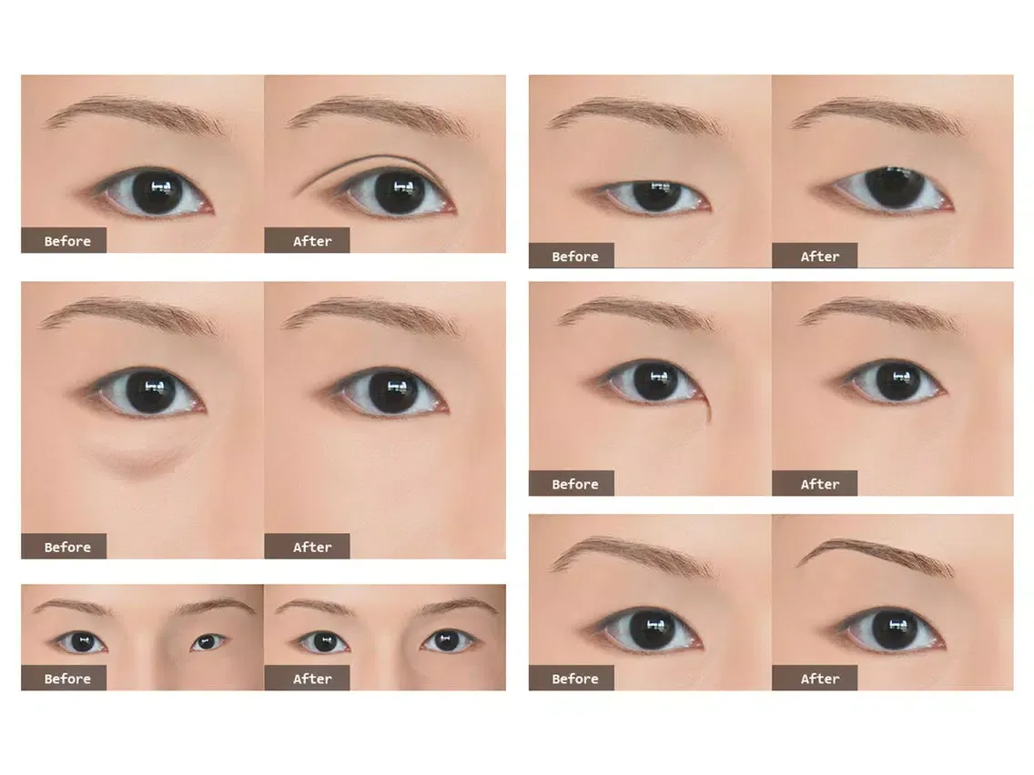 Photo Plastic Surgery Professional iPad  Ekran Görüntüleri