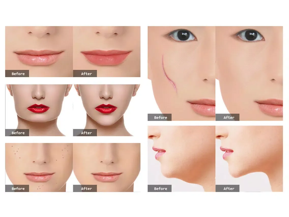 Photo Plastic Surgery Professional iPad  Ekran Görüntüleri