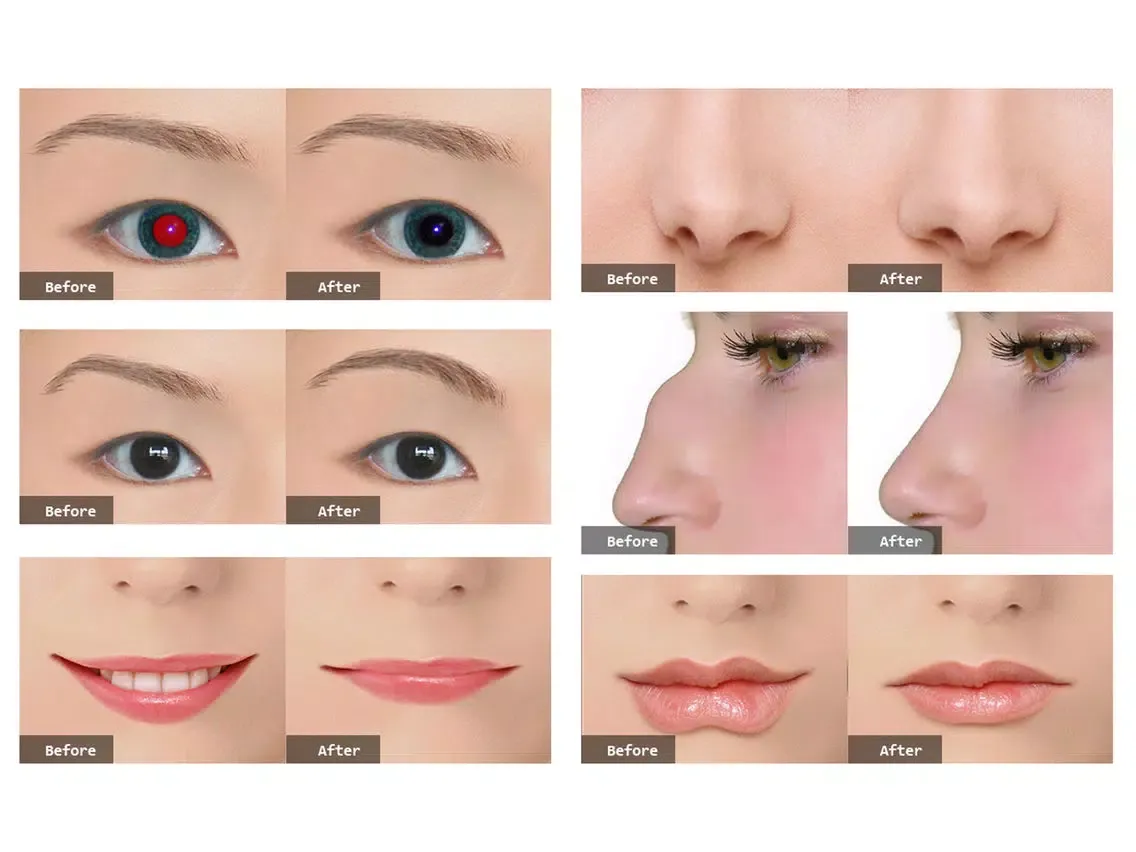 Photo Plastic Surgery Professional iPad  Ekran Görüntüleri