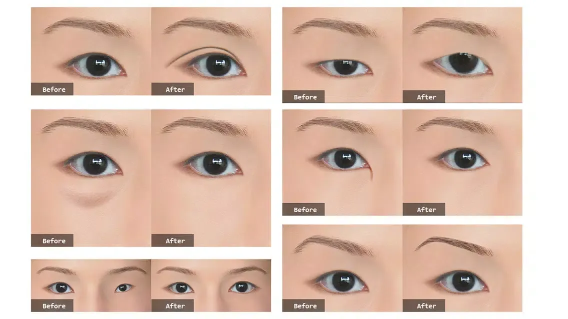 Photo Plastic Surgery Professional Ekran Görüntüleri