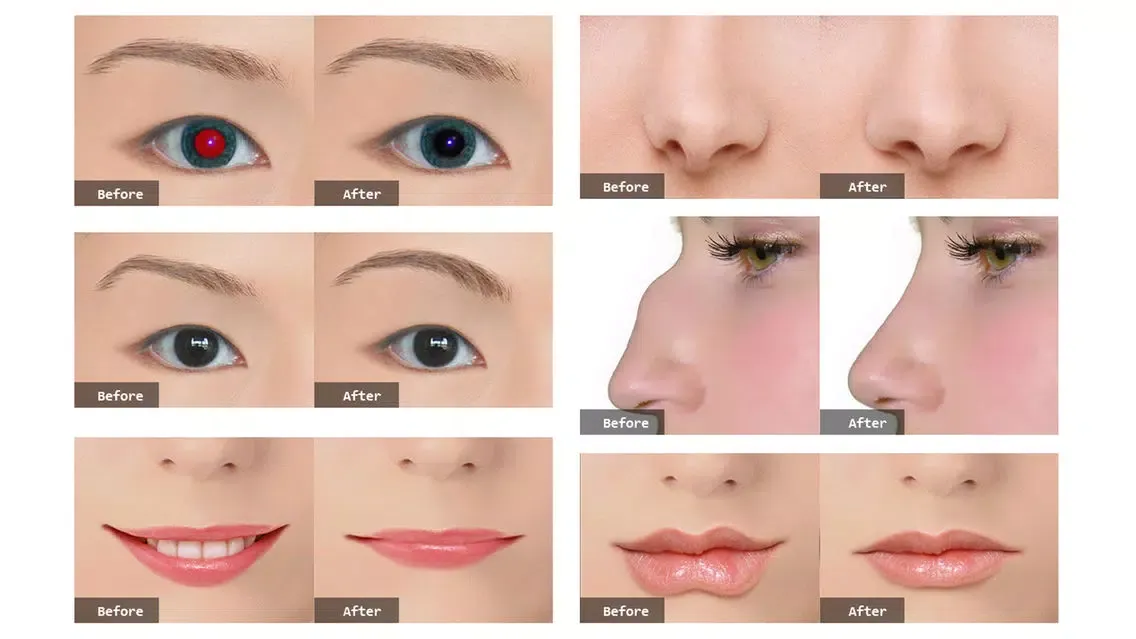 Photo Plastic Surgery Professional Ekran Görüntüleri