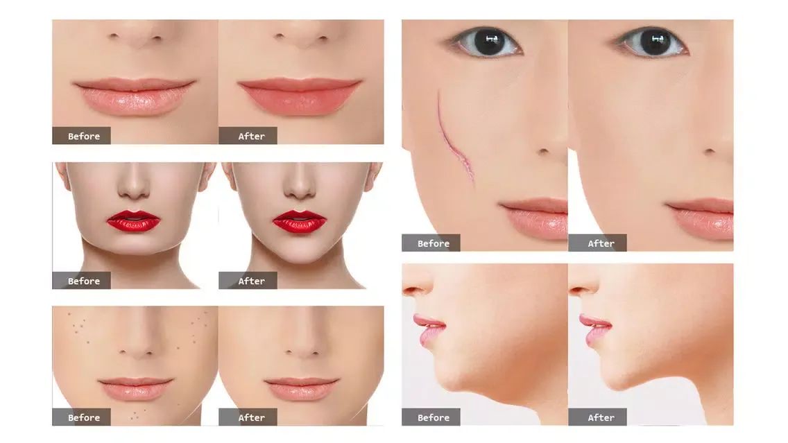 Photo Plastic Surgery Professional Ekran Görüntüleri