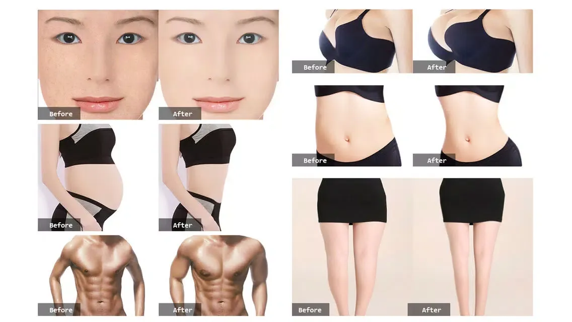 Photo Plastic Surgery Professional Ekran Görüntüleri