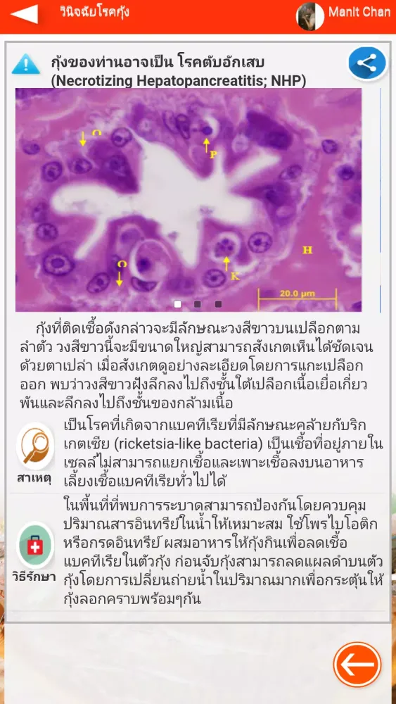 Shrimp-dis應用截圖