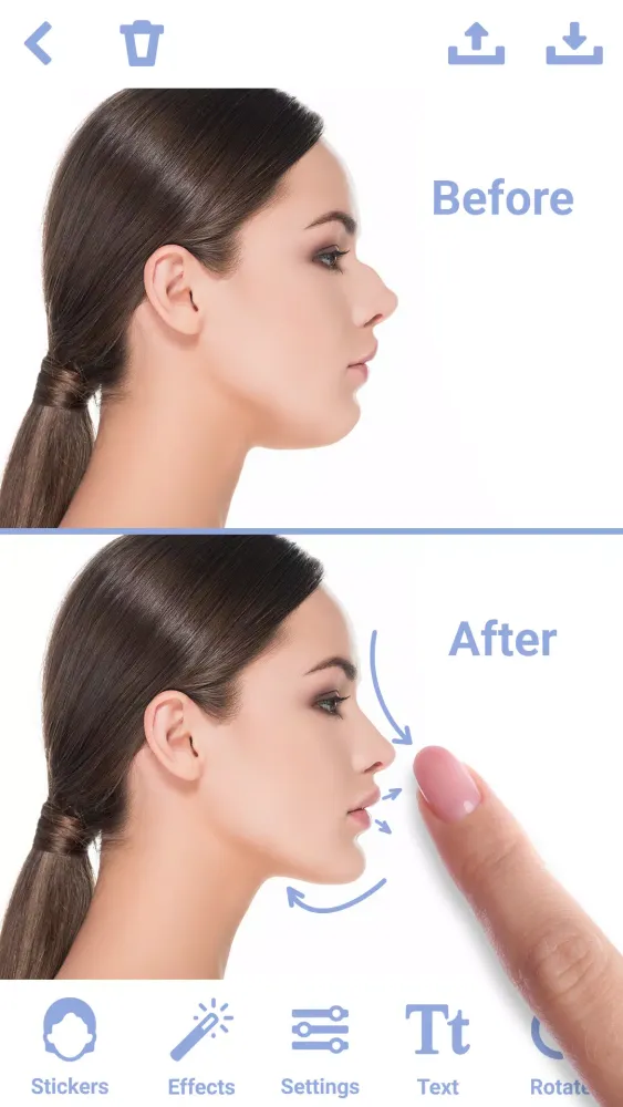 Rhinoplasty Screenshots