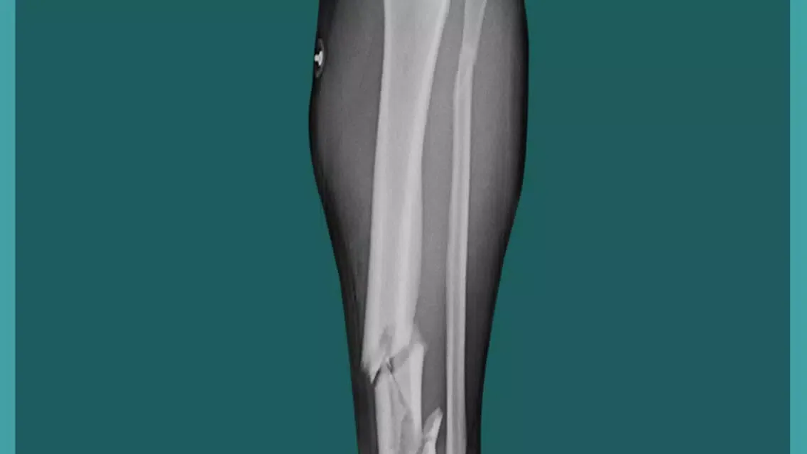 Leg Surgery Doctor Operation স্ক্রিনশট