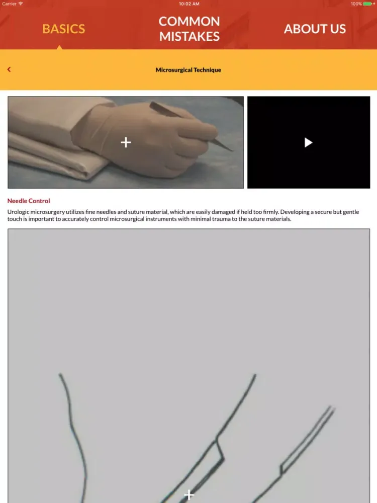 ภาพหน้าจอของ Male Infertility Microsurgery iPad 