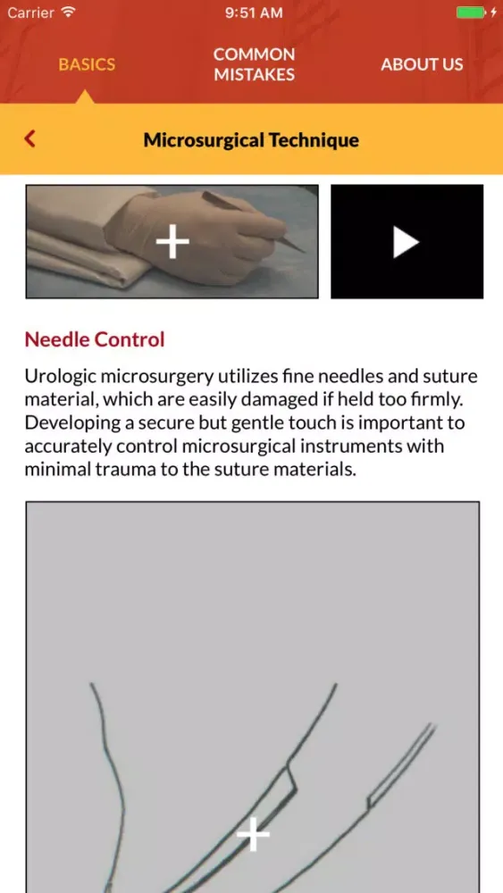 ภาพหน้าจอของ Male Infertility Microsurgery