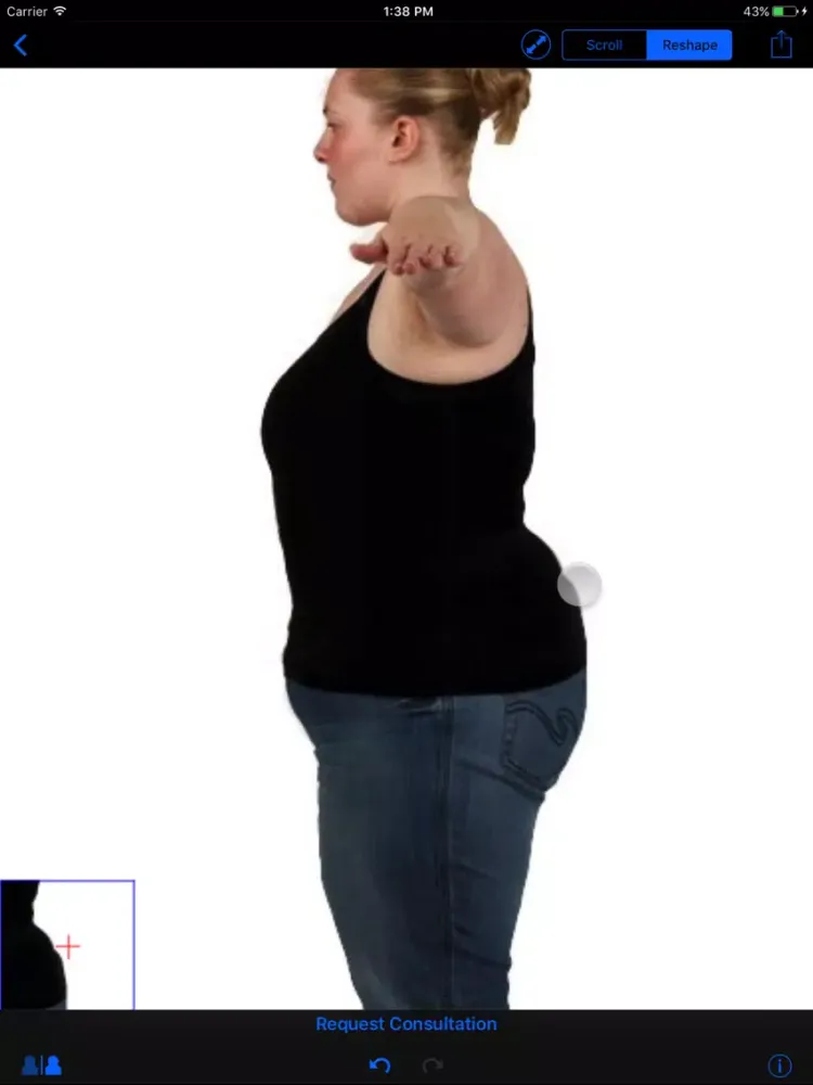 تصاویر Shaper Bariatric Surgery iPad 