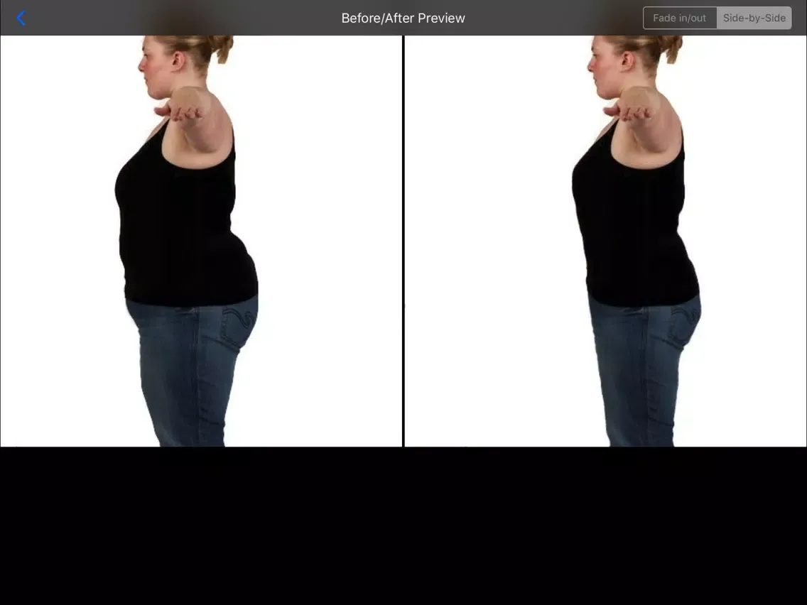 تصاویر Shaper Bariatric Surgery iPad 