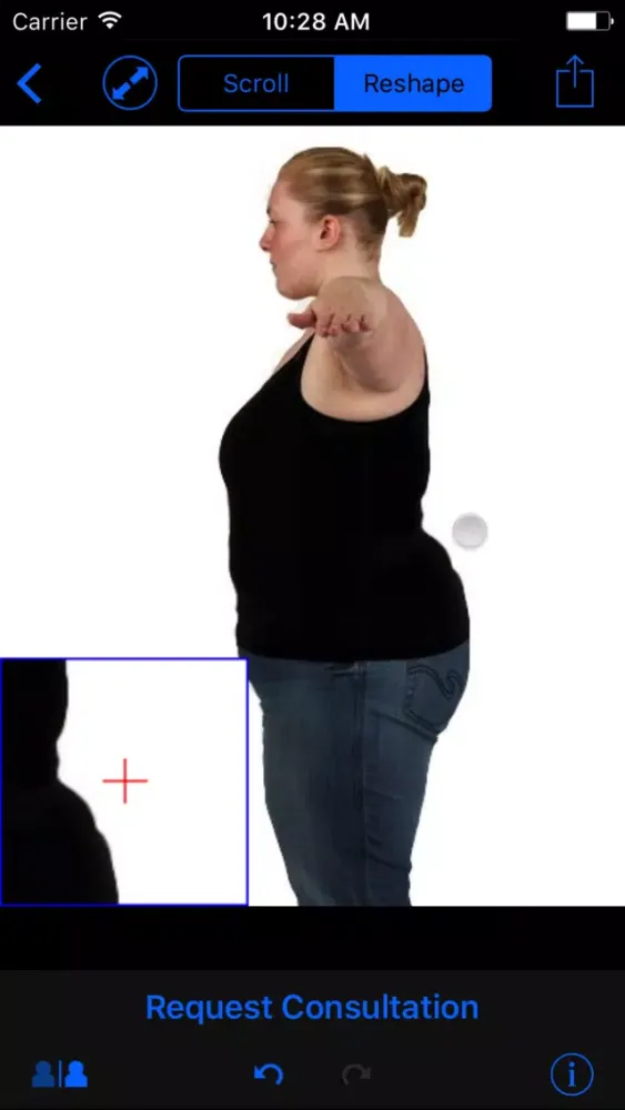 تصاویر Shaper Bariatric Surgery