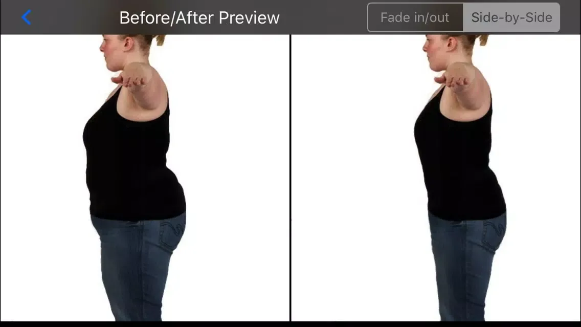 تصاویر Shaper Bariatric Surgery