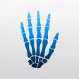 UL Impairment Calculator UL Impairment Calculator