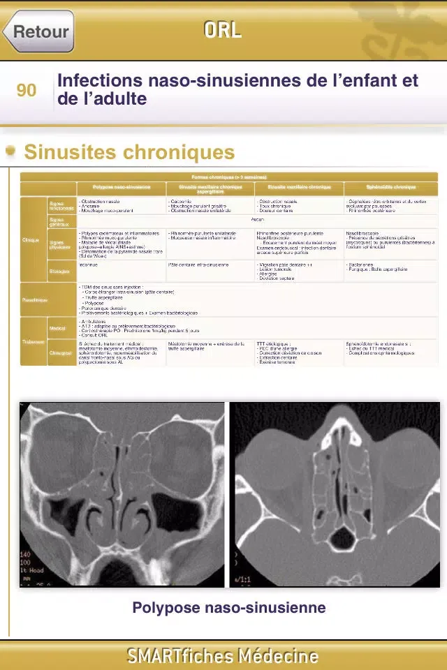 SMARTfiches Oto-Rhino-Laryngologie Free स्क्रीनशॉट