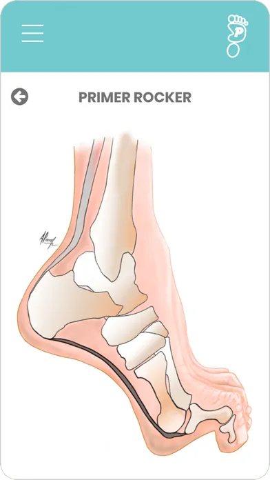 Pocket Foot and Ankle Screenshots