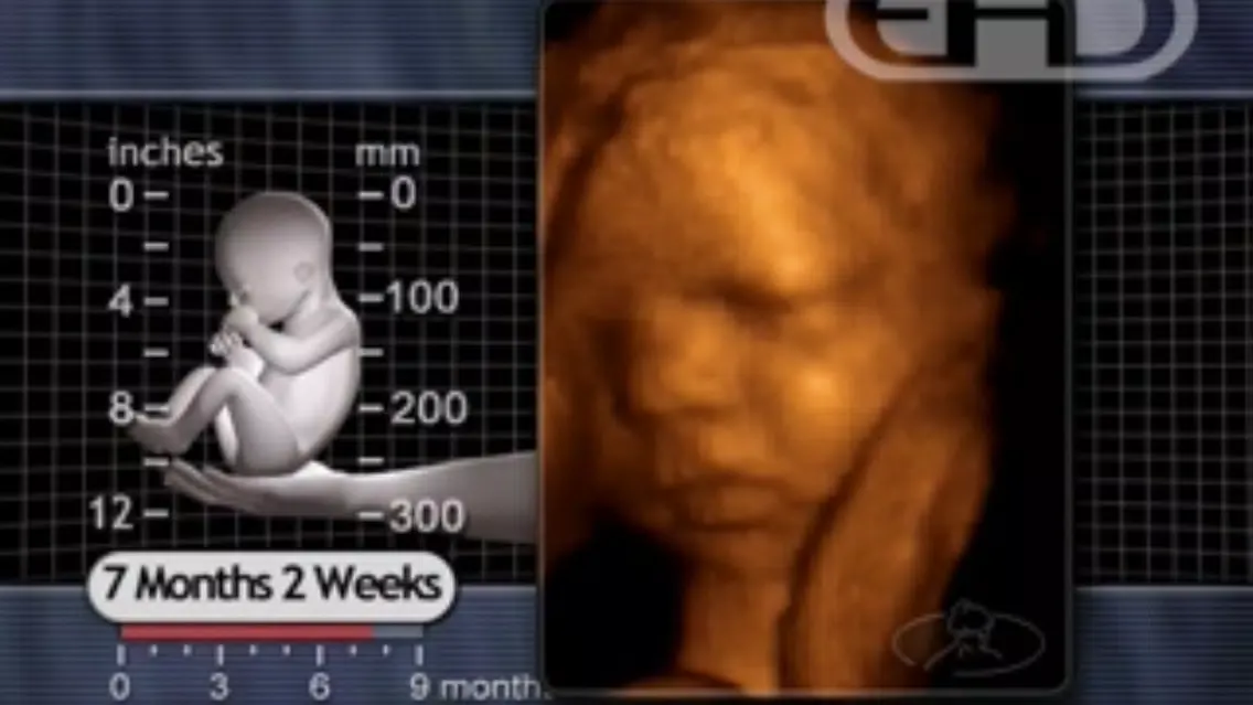 Pregnancy Choices スクリーンショット