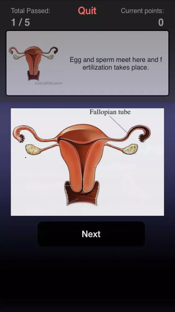 Pregnancy Choices スクリーンショット
