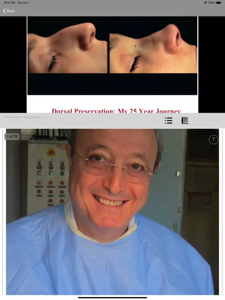 صور Preservation Rhinoplasty iPad 