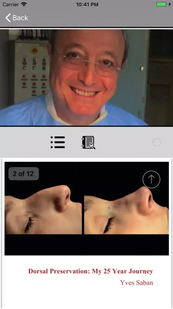 صور Preservation Rhinoplasty