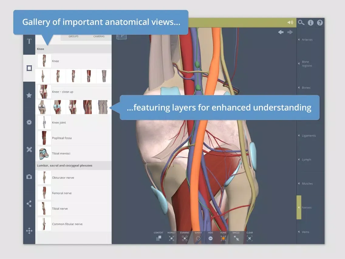 Knee: 3D Real-time iPad  Ekran Görüntüleri