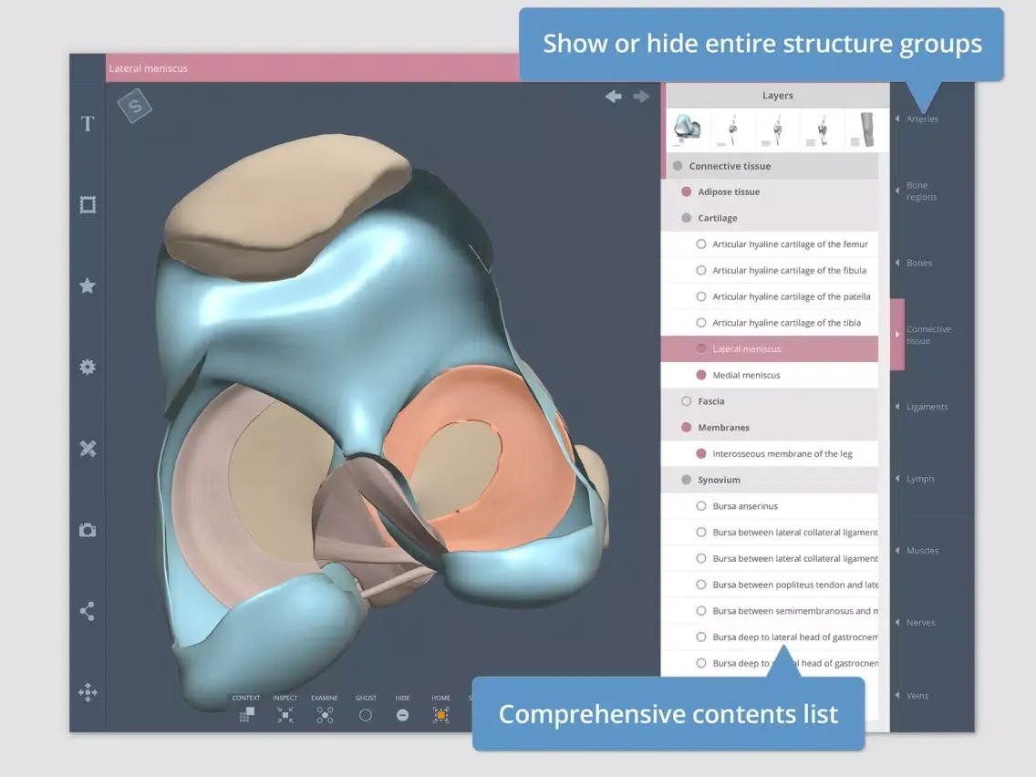 Knee: 3D Real-time iPad  Ekran Görüntüleri