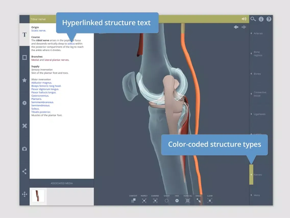 Knee: 3D Real-time iPad  Ekran Görüntüleri