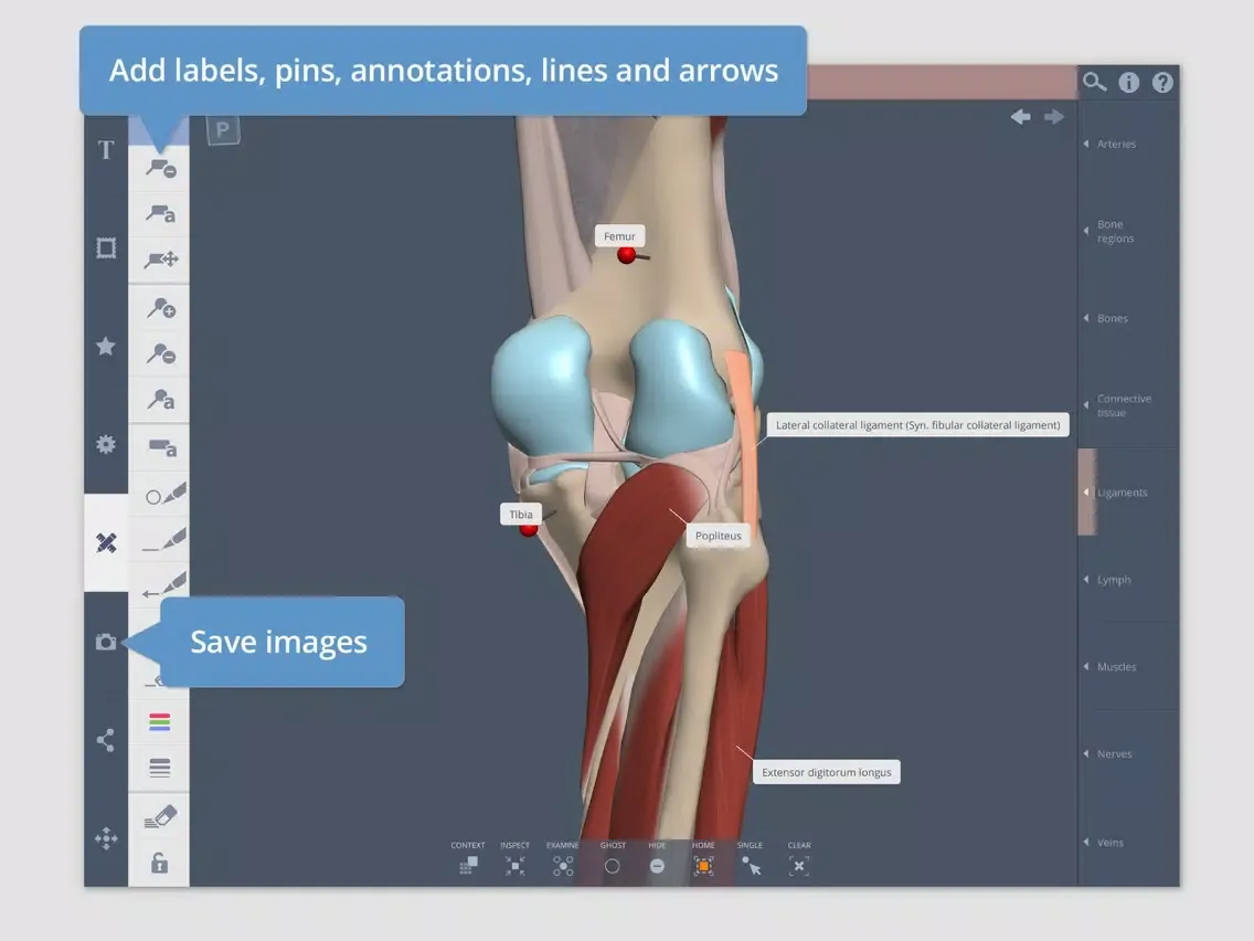 Knee: 3D Real-time iPad  Ekran Görüntüleri