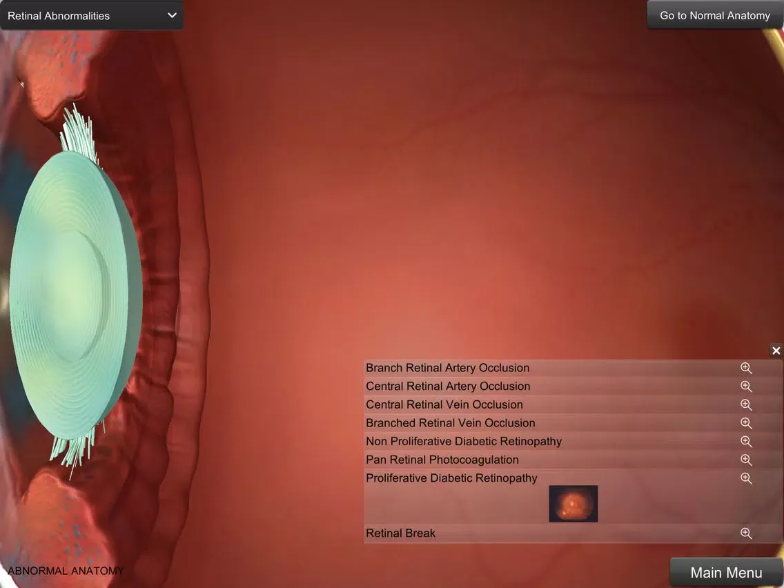 Eye Anatomy iPad  Ekran Görüntüleri