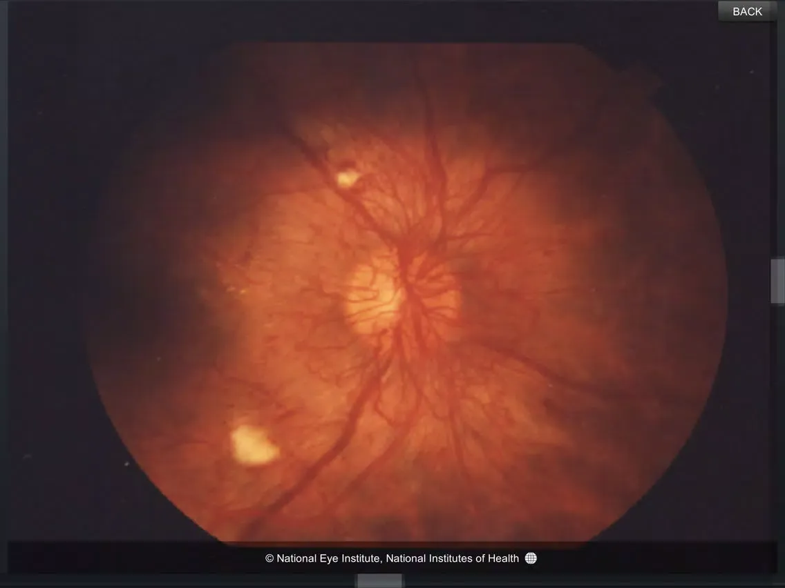 Eye Anatomy iPad  Ekran Görüntüleri