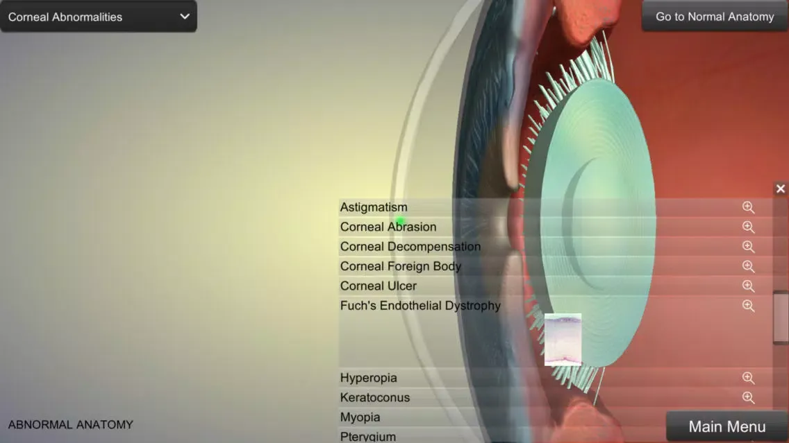 Eye Anatomy Ekran Görüntüleri