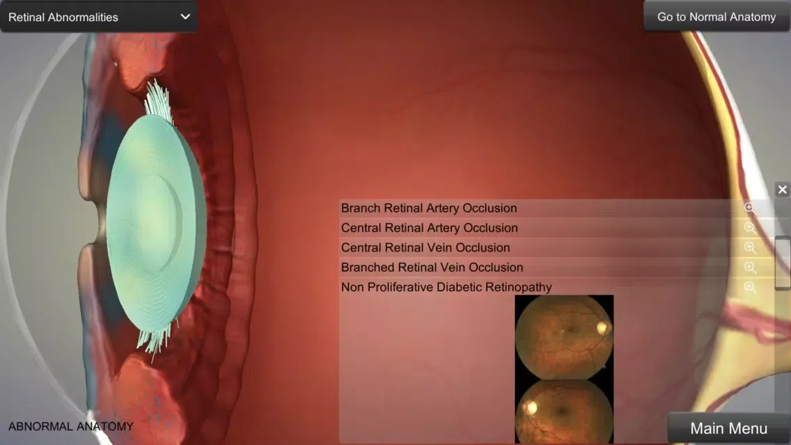 Eye Anatomy Ekran Görüntüleri