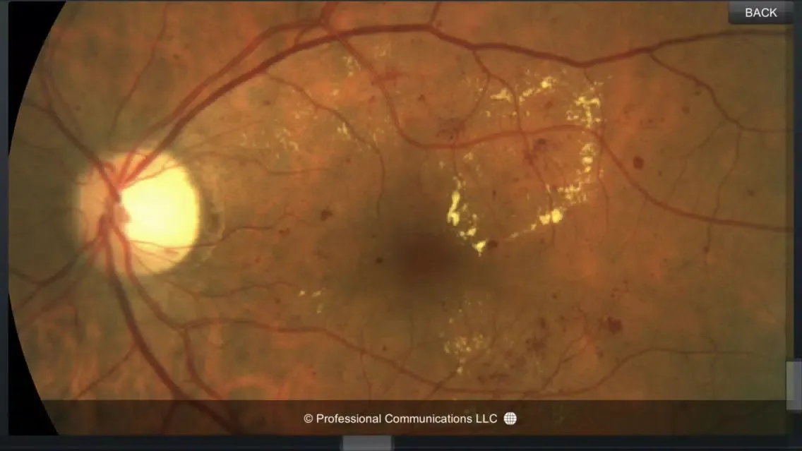 Eye Anatomy Ekran Görüntüleri