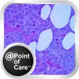 Mieloma Múltiple @Point of Care™