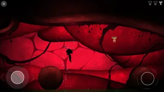 ภาพหน้าจอของ Nightmare: Malaria