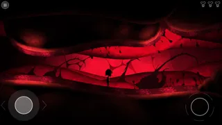 ภาพหน้าจอของ Nightmare: Malaria