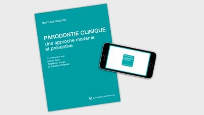 صور Parodontie clinique