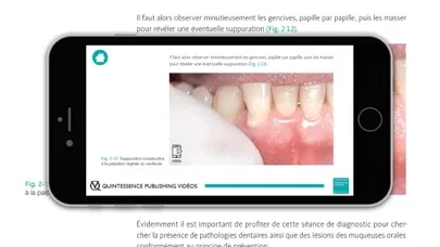 صور Parodontie clinique