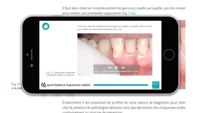 صور Parodontie clinique