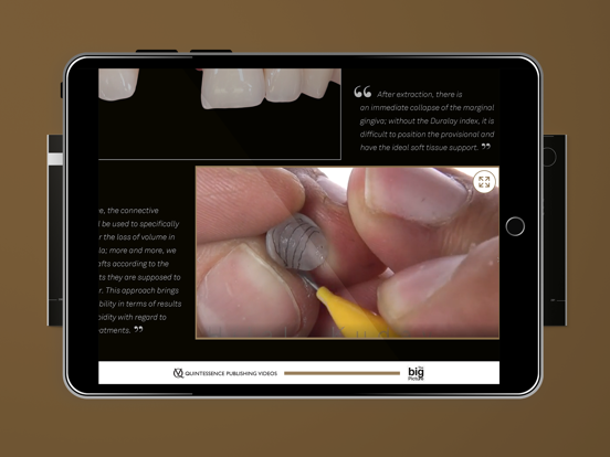 Quintessence The big Picture iPad  Screenshots