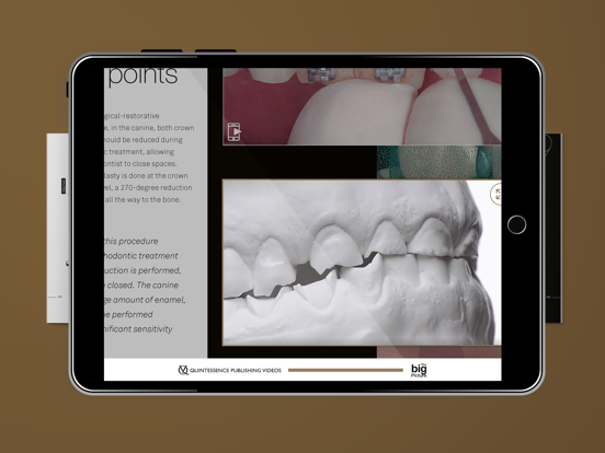 Quintessence The big Picture iPad  Screenshots