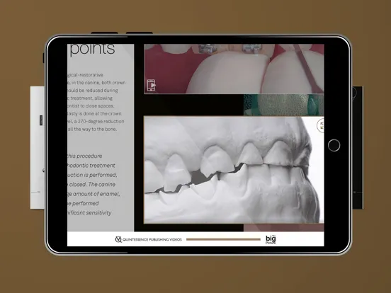 Screenshot di Quintessence The big Picture iPad 
